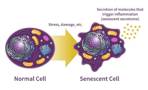 Normal Cell becomes stressed and damaged. Resulting to the normal cell becoming Senescent Cell that triggers inflammation.