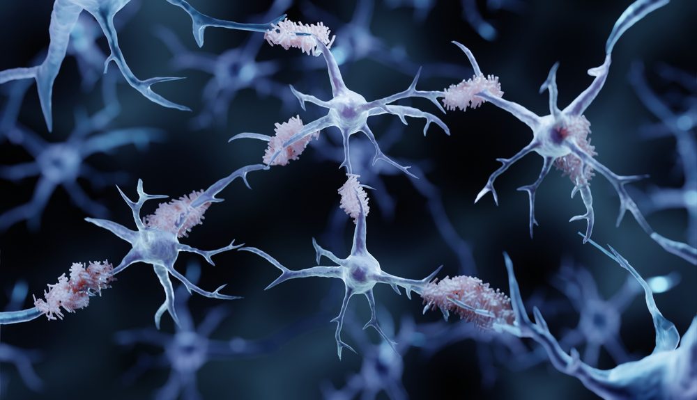 Your Brain’s Housekeeper: The Microglia System